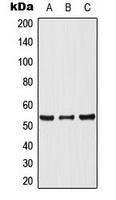 p53 Rabbit Polyclonal Antibody