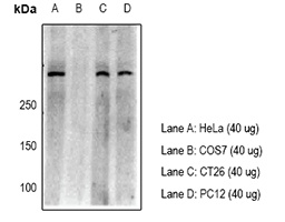 53BP1 Rabbit Polyclonal Antibody