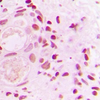 53BP1 Rabbit Polyclonal Antibody