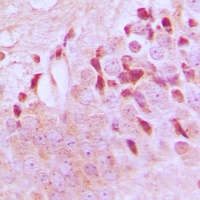 TSC2 (Phospho-T1462) Antibody