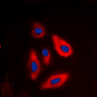 TSC2 (Phospho-T1462) Antibody