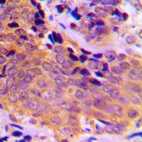 VASP (Phospho-S157) Rabbit Polyclonal Antibody