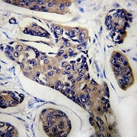 NCOA4 Rabbit Polyclonal Antibody