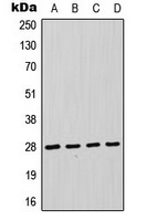 FADD Rabbit Polyclonal Antibody