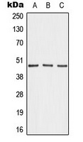 AKAP5 Rabbit Polyclonal Antibody