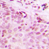 Separase (Phospho-S1126/801) Antibody