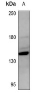 ZEB2 Rabbit Polyclonal Antibody