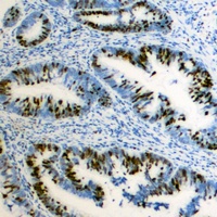 ZEB2 Rabbit Polyclonal Antibody