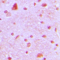 ARNT2 Rabbit Polyclonal Antibody