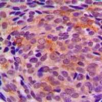 LYPLA1 Rabbit Polyclonal Antibody