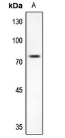 AKAP10 Rabbit Polyclonal Antibody