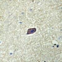 AKAP10 Rabbit Polyclonal Antibody