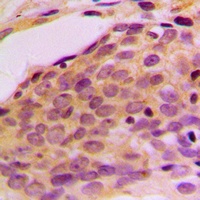 p116 Rip Rabbit Polyclonal Antibody