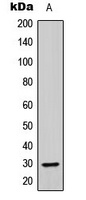 ABHD14A Rabbit Polyclonal Antibody