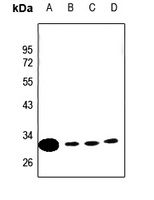 CLIC4 Rabbit Polyclonal Antibody