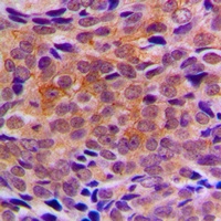 ARFIP1 Rabbit Polyclonal Antibody