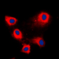 ARFIP1 Rabbit Polyclonal Antibody