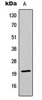 MRPL13 Rabbit Polyclonal Antibody
