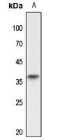 TRA2A Rabbit Polyclonal Antibody