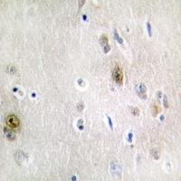 TRA2A Rabbit Polyclonal Antibody