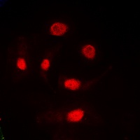 TRA2A Rabbit Polyclonal Antibody