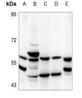 TBX22 Rabbit Polyclonal Antibody