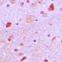 TBX22 Rabbit Polyclonal Antibody