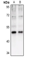 CK1 gamma 1 Rabbit Polyclonal Antibody