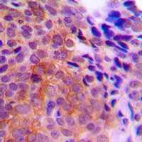 CK1 gamma 1 Rabbit Polyclonal Antibody