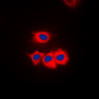 CK1 gamma 1 Rabbit Polyclonal Antibody