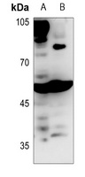 BAIAP2L1 Rabbit Polyclonal Antibody