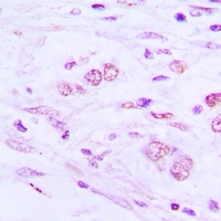 BAIAP2L1 Rabbit Polyclonal Antibody