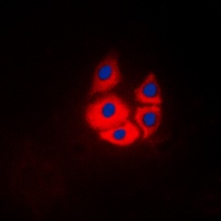 MARK4 Rabbit Polyclonal Antibody