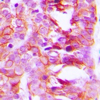 KCNK15 Rabbit Polyclonal Antibody