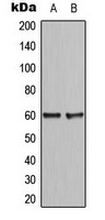 CCDC102B Rabbit Polyclonal Antibody