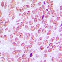 CCDC102B Rabbit Polyclonal Antibody