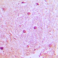 UBTD1 Rabbit Polyclonal Antibody