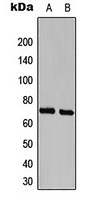 CDK5RAP3 Rabbit Polyclonal Antibody