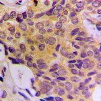 CDK5RAP3 Rabbit Polyclonal Antibody