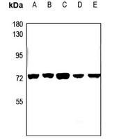 CEP70 Rabbit Polyclonal Antibody