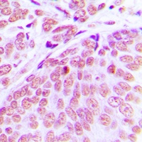 CEP70 Rabbit Polyclonal Antibody