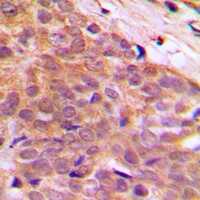 CABLES1 Rabbit Polyclonal Antibody