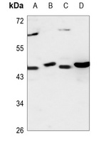 CEP41 Rabbit Polyclonal Antibody