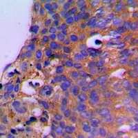 CEP41 Rabbit Polyclonal Antibody