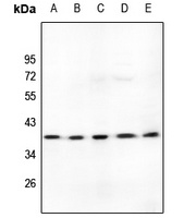 LDLRAD3 Rabbit Polyclonal Antibody