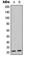 MRPL21 Rabbit Polyclonal Antibody