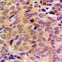 MRPL21 Rabbit Polyclonal Antibody