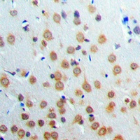 ANKRD20A3 Rabbit Polyclonal Antibody