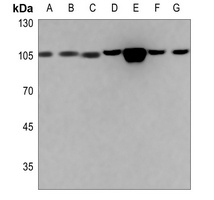 ACTN1/2/3/4 Antibody