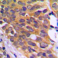 EEF2K (Phospho-S366) Rabbit Polyclonal Antibody